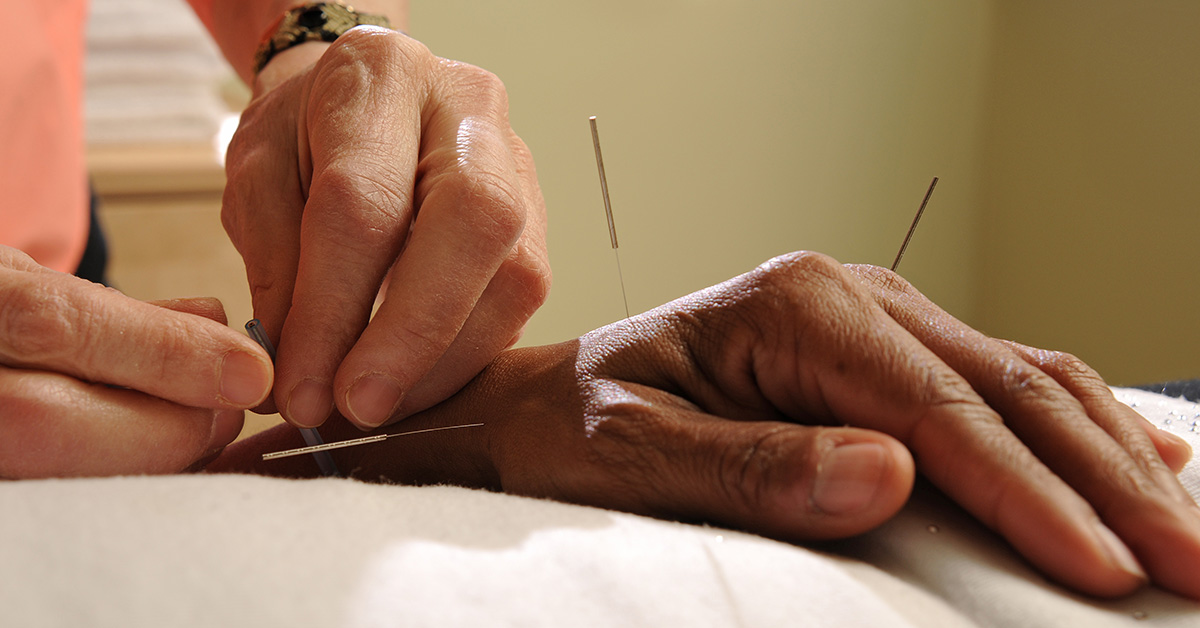 Acupuncture with Electric Stimulation - Acupuncture & Physical Therapy  Specialist