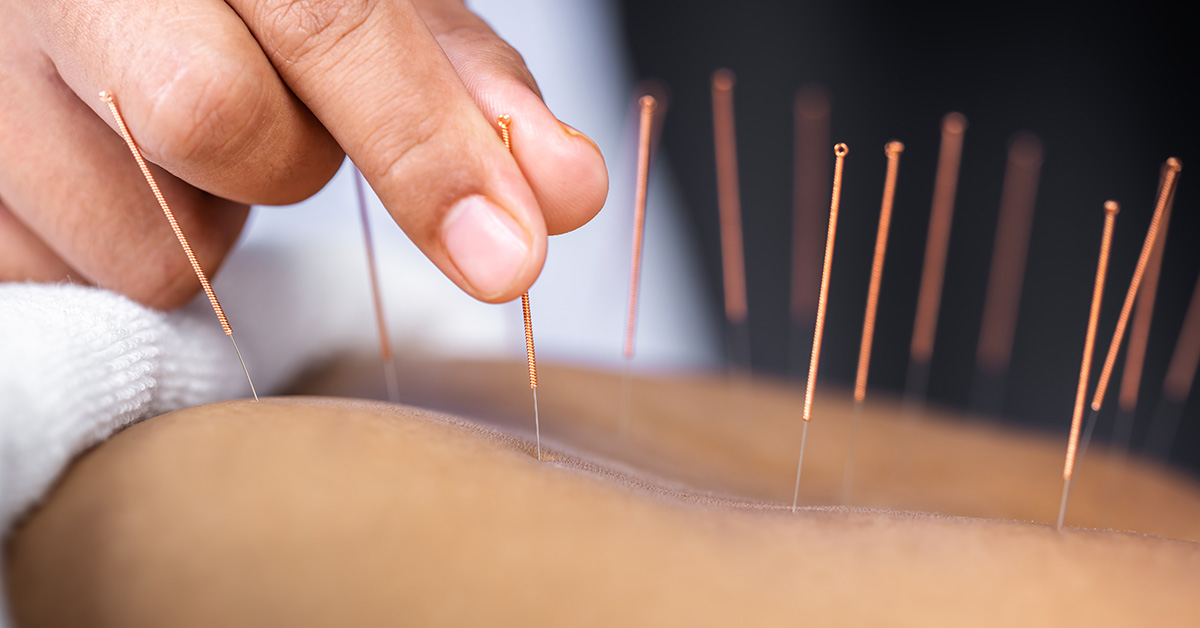 Acupuncture Energetics 東洋医学 Acupuncture in Port Jefferson Station