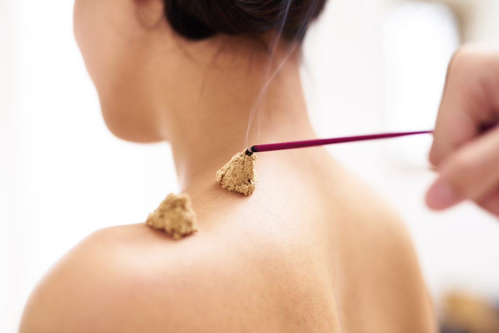 Person receiving Moxibustion Aroma Therapy on their shoulder